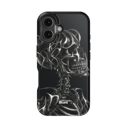 X-Ray iPhone Case