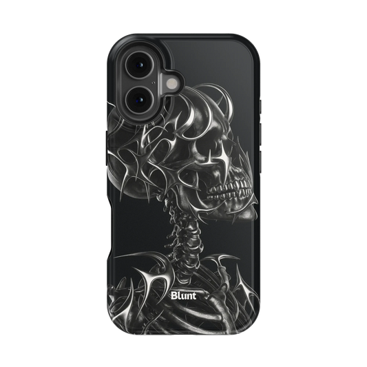 X-Ray iPhone Case