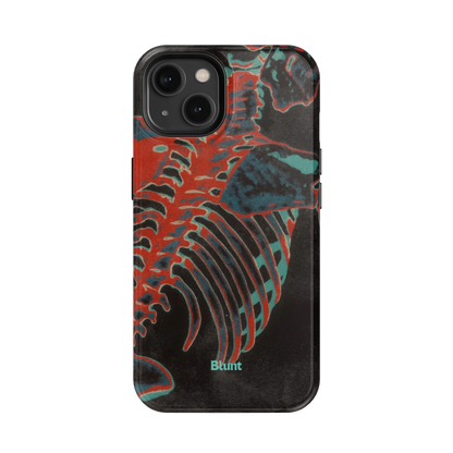 Bone Shredder iPhone Case