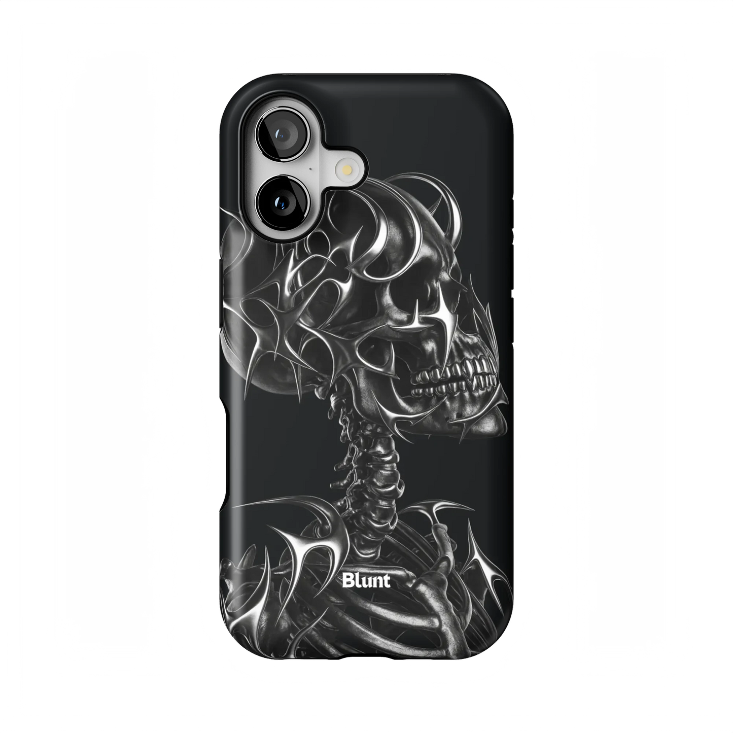 X-Ray iPhone Case
