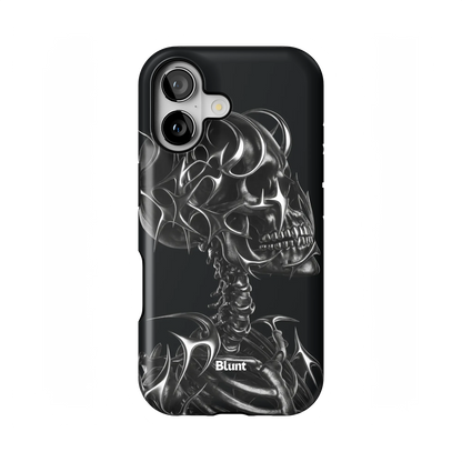 X-Ray iPhone Case