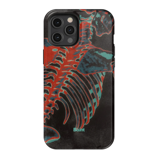 Bone Shredder iPhone Case