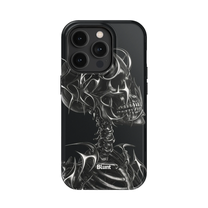 X-Ray iPhone Case