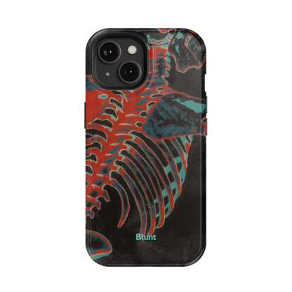 Bone Shredder iPhone Case