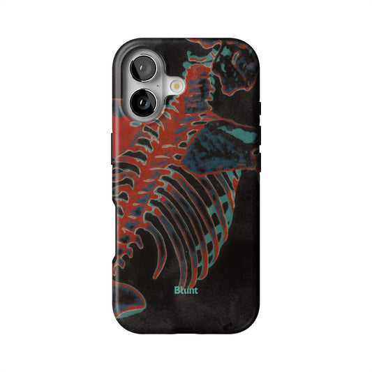Bone Shredder iPhone Case gallery - Iphone_17_Iphone_1