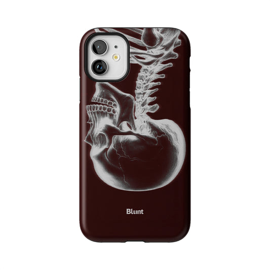 Crimson Cranium iPhone Case gallery - Iphone_11_Iphone_1