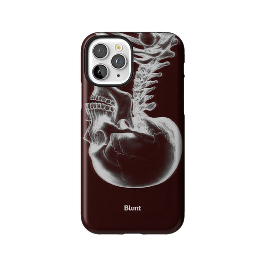 Crimson Cranium iPhone Case gallery - Iphone_11_Pro_1