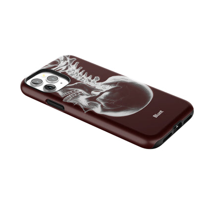 Crimson Cranium iPhone Case gallery - Iphone_11_Pro_2