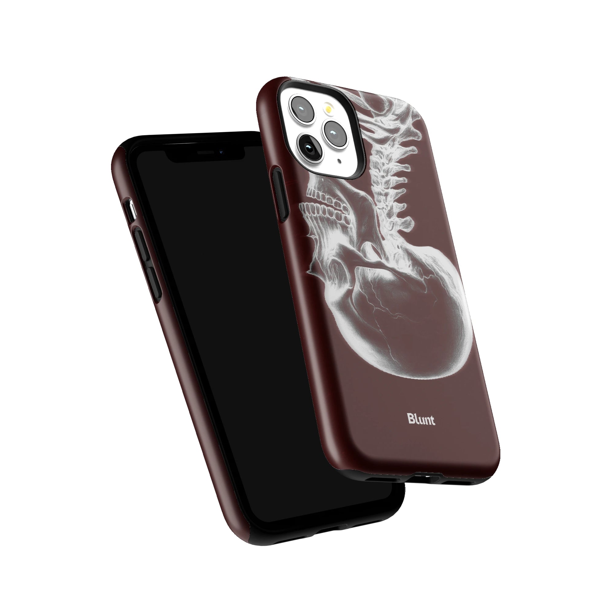 Crimson Cranium iPhone Case gallery - Iphone_11_Pro_6