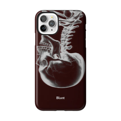 Crimson Cranium iPhone Case gallery - Iphone_11_Pro_Max_1