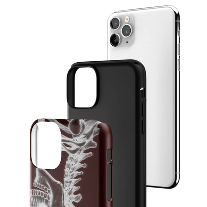 Crimson Cranium iPhone Case gallery - Iphone_11_Pro_Max_3