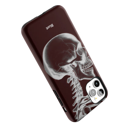 Crimson Cranium iPhone Case gallery - Iphone_11_Pro_Max_5