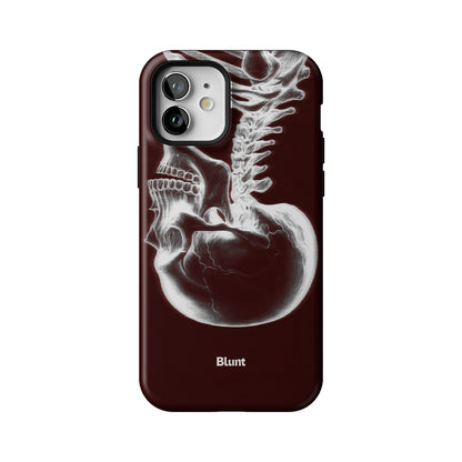Crimson Cranium iPhone Case gallery - Iphone_12_Iphone_1