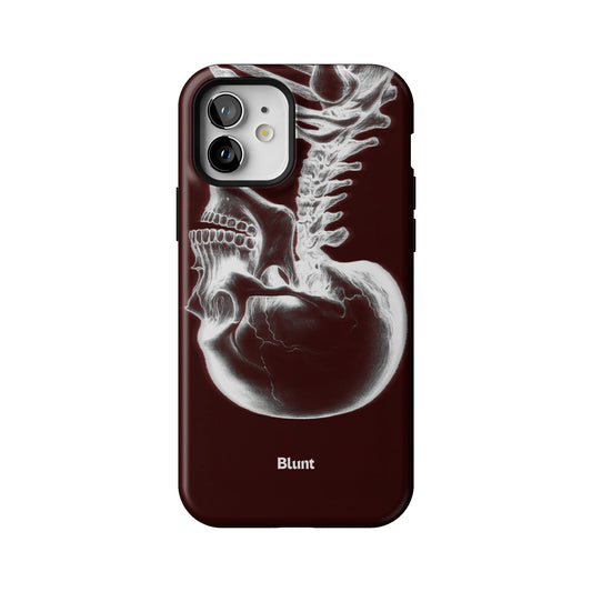 Crimson Cranium iPhone Case gallery - Iphone_12_Iphone_1