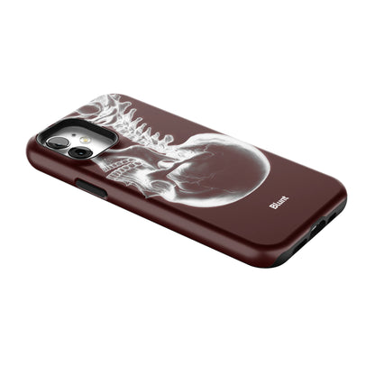 Crimson Cranium iPhone Case gallery - Iphone_12_Iphone_2