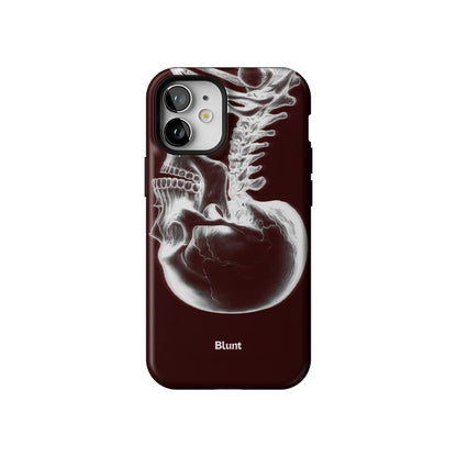 Crimson Cranium iPhone Case gallery - Iphone_12_Mini_Air_Plus_1