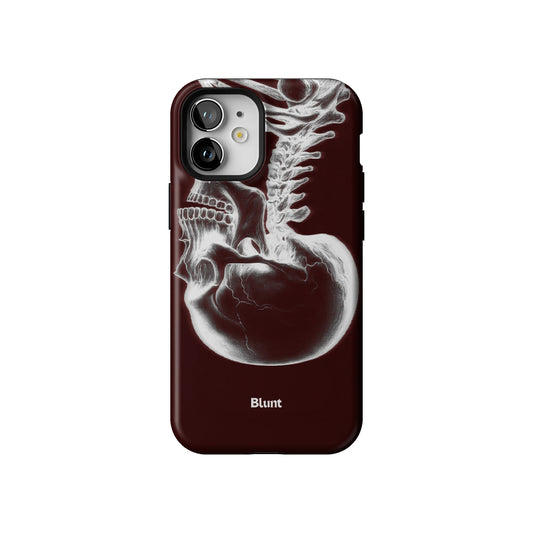 Crimson Cranium iPhone Case gallery - Iphone_12_Mini_Air_Plus_1