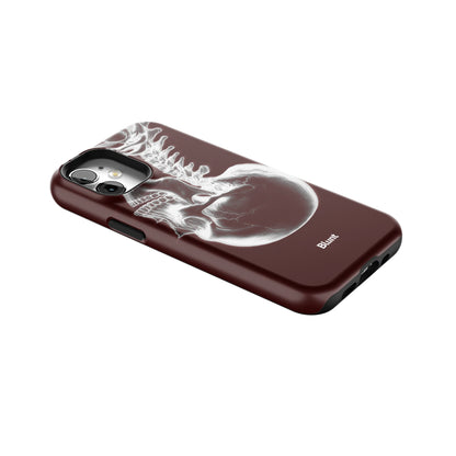 Crimson Cranium iPhone Case gallery - Iphone_12_Mini_Air_Plus_2