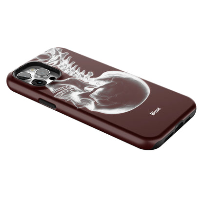 Crimson Cranium iPhone Case gallery - Iphone_12_Pro_Max_2