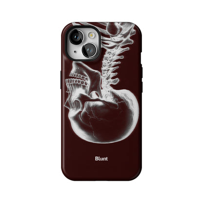 Crimson Cranium iPhone Case gallery - Iphone_13_Iphone_1