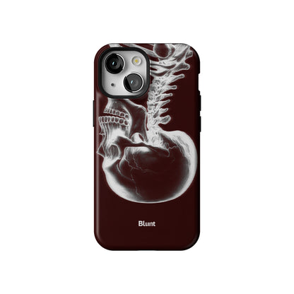 Crimson Cranium iPhone Case gallery - Iphone_13_Mini_Air_Plus_1
