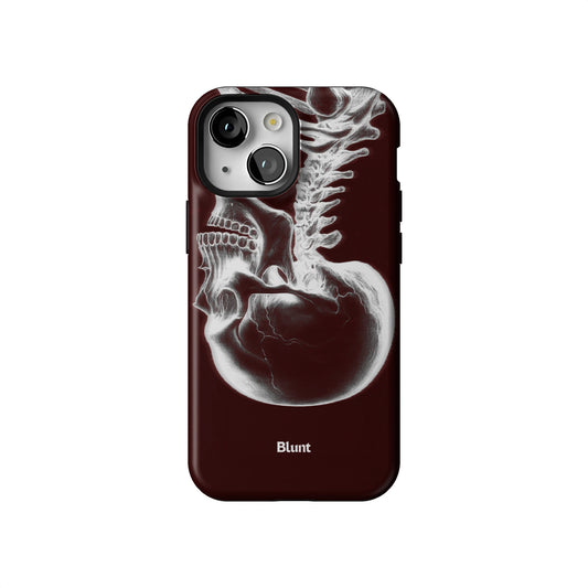 Crimson Cranium iPhone Case gallery - Iphone_13_Mini_Air_Plus_1
