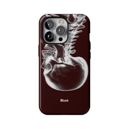 Crimson Cranium iPhone Case gallery - Iphone_13_Pro_1