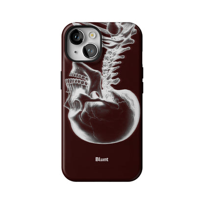 Crimson Cranium iPhone Case gallery - Iphone_14_Iphone_1