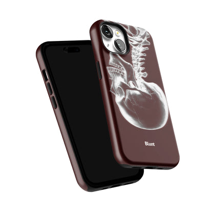 Crimson Cranium iPhone Case gallery - Iphone_14_Iphone_6