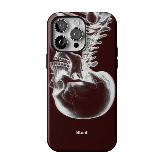 Crimson Cranium iPhone Case gallery - Iphone_14_Pro_Max_1
