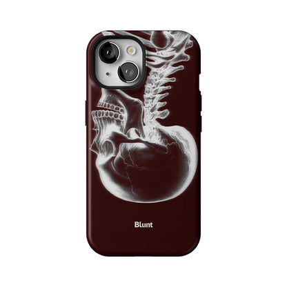 Crimson Cranium iPhone Case gallery - Iphone_15_Iphone_1