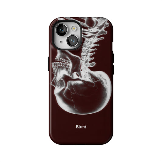 Crimson Cranium iPhone Case gallery - Iphone_15_Iphone_1