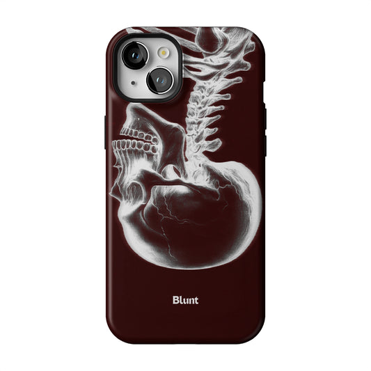 Crimson Cranium iPhone Case gallery - Iphone_15_Mini_Air_Plus_1