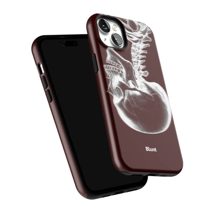 Crimson Cranium iPhone Case gallery - Iphone_15_Mini_Air_Plus_6