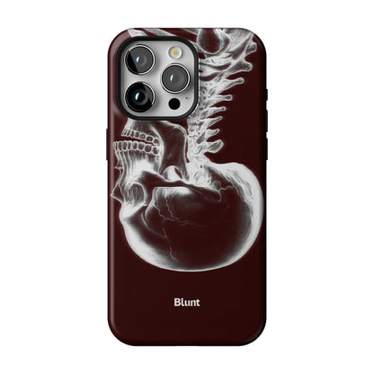 Crimson Cranium iPhone Case gallery - Iphone_15_Pro_Max_1
