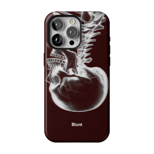 Crimson Cranium iPhone Case gallery - Iphone_15_Pro_Max_1