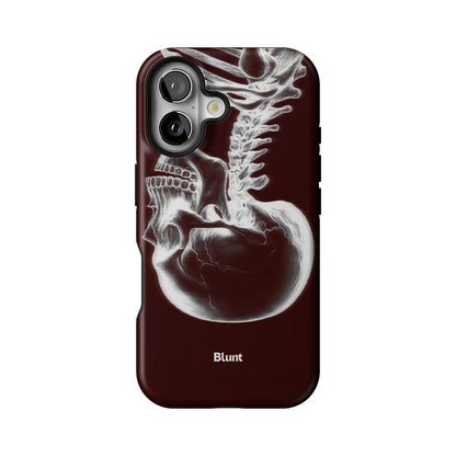 Crimson Cranium iPhone Case gallery - Iphone_16_Iphone_1