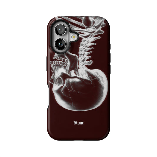 Crimson Cranium iPhone Case gallery - Iphone_16_Iphone_1