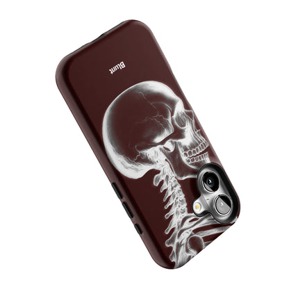 Crimson Cranium iPhone Case gallery - Iphone_16_Iphone_5