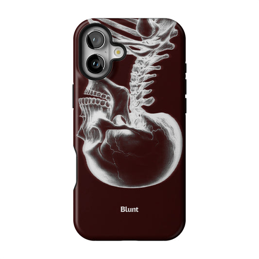 Crimson Cranium iPhone Case gallery - Iphone_16_Mini_Air_Plus_1