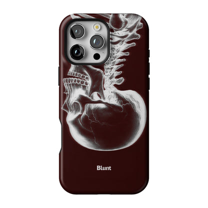 Crimson Cranium iPhone Case gallery - Iphone_16_Pro_Max_1