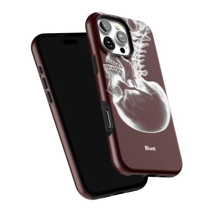 Crimson Cranium iPhone Case gallery - Iphone_16_Pro_Max_6