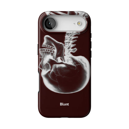 Crimson Cranium iPhone Case gallery - Iphone_17_Air_1