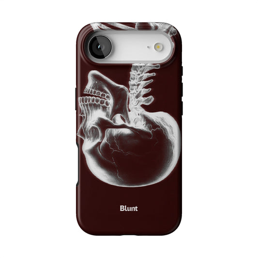 Crimson Cranium iPhone Case gallery - Iphone_17_Air_1