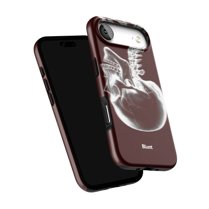 Crimson Cranium iPhone Case gallery - Iphone_17_Air_6