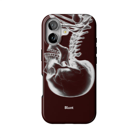 Crimson Cranium iPhone Case gallery - Iphone_17_Iphone_1