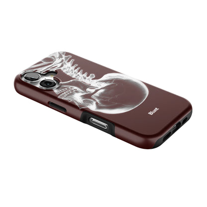 Crimson Cranium iPhone Case gallery - Iphone_17_Iphone_2