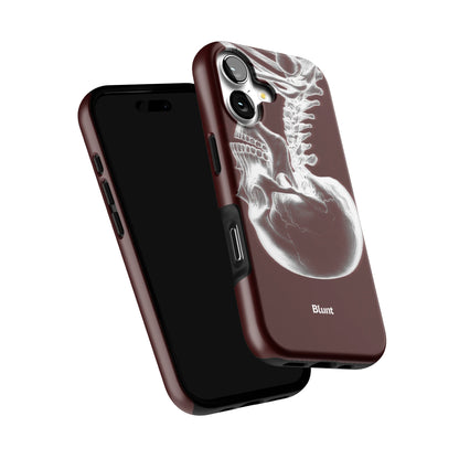 Crimson Cranium iPhone Case gallery - Iphone_17_Iphone_6