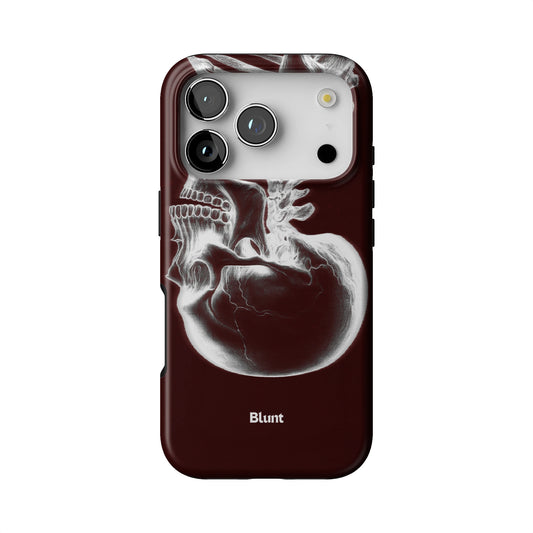 Crimson Cranium iPhone Case gallery - Iphone_17_Pro_1