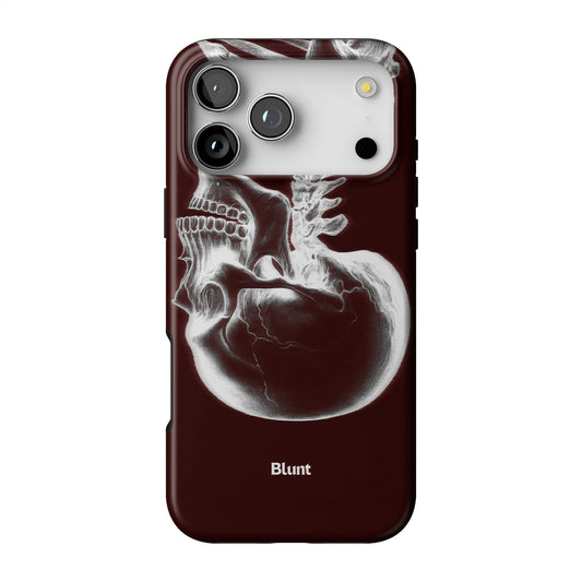 Crimson Cranium iPhone Case gallery - Iphone_17_Pro_Max_1